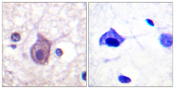 CD4 Antibody - Immunohistochemistry analysis of paraffin-embedded human brain, using CD4 (Phospho-Ser433) Antibody. The picture on the right is blocked with the phospho peptide.