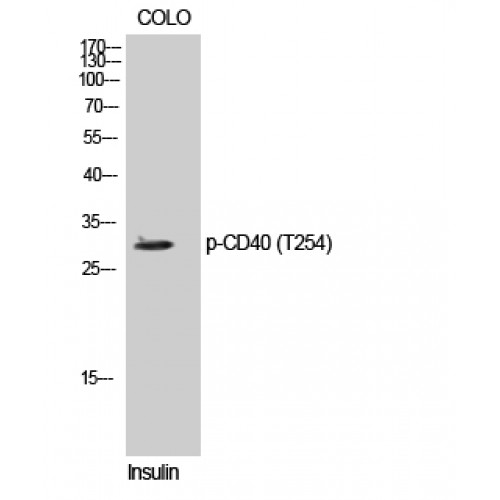 CD40 Antibody - Western blot of Phospho-CD40 (T254) antibody