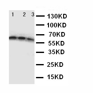 CD40 Antibody - CD40 antibody Western blot. Lane 1: Recombinant Human CD40 Protein 10ng. Lane 2: Recombinant Human CD40 Protein 5ng. Lane 3: Recombinant Human CD40 Protein 2.5ng.