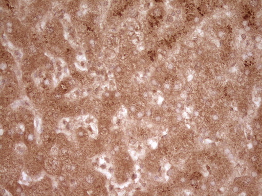 CD40 Antibody - IHC of paraffin-embedded Human liver tissue using anti-CD40 mouse monoclonal antibody. (Heat-induced epitope retrieval by 1 mM EDTA in 10mM Tris, pH8.5, 120°C for 3min).