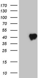 CD40 Antibody - HEK293T cells were transfected with the pCMV6-ENTRY control. (Left lane) or pCMV6-ENTRY CD40. (Right lane) cDNA for 48 hrs and lysed. Equivalent amounts of cell lysates. (5 ug per lane) were separated by SDS-PAGE and immunoblotted with anti-CD40.