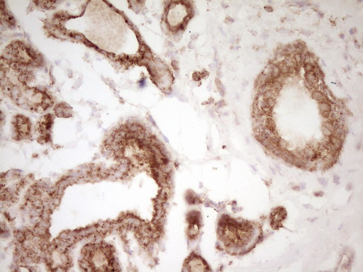 CD40 Antibody - Immunohistochemical staining of paraffin-embedded Human breast tissue using anti-CD40 mouse monoclonal antibody. (Heat-induced epitope retrieval by Tris-EDTA, pH8.0)