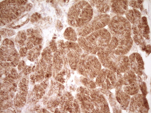 CD40 Antibody - Immunohistochemical staining of paraffin-embedded Human pancreas tissue using anti-CD40 mouse monoclonal antibody. (Heat-induced epitope retrieval by Tris-EDTA, pH8.0)