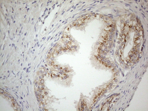 CD40 Antibody - Immunohistochemical staining of paraffin-embedded Human prostate tissue using anti-CD40 mouse monoclonal antibody. (Heat-induced epitope retrieval by 1mM EDTA in 10mM Tris buffer. (pH8.5) at 120°C for 3 min. (1:150)