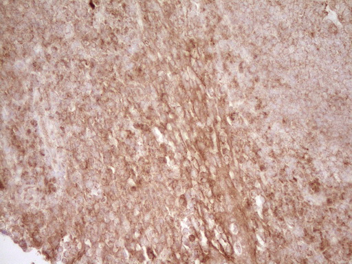 CD40 Antibody - Immunohistochemical staining of paraffin-embedded Human tonsil using anti-CD40 mouse monoclonal antibody. (Heat-induced epitope retrieval by Tris-EDTA, pH8.0)