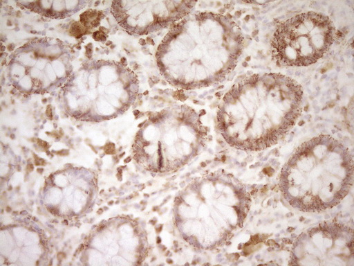 CD40 Antibody - Immunohistochemical staining of paraffin-embedded Human colon tissue using anti-CD40 mouse monoclonal antibody. (Heat-induced epitope retrieval by Tris-EDTA, pH8.0)