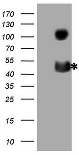 CD40 Antibody - HEK293T cells were transfected with the pCMV6-ENTRY control (Left lane) or pCMV6-ENTRY CD40 (Right lane) cDNA for 48 hrs and lysed. Equivalent amounts of cell lysates (5 ug per lane) were separated by SDS-PAGE and immunoblotted with anti-CD40 (1:2000).