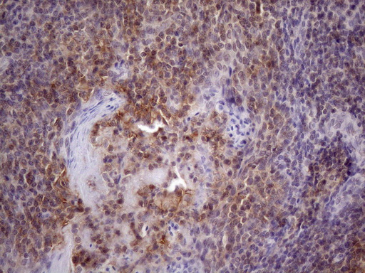 CD40 Antibody - IHC of paraffin-embedded Human tonsil using anti-CD40 mouse monoclonal antibody. (Heat-induced epitope retrieval by 1 mM EDTA in 10mM Tris, pH8.5, 120°C for 3min)(1:150).