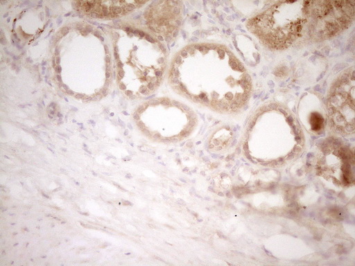 CD40 Antibody - IHC of paraffin-embedded Human Kidney tissue using anti-CD40 mouse monoclonal antibody. (Heat-induced epitope retrieval by 1 mM EDTA in 10mM Tris, pH8.5, 120°C for 3min).
