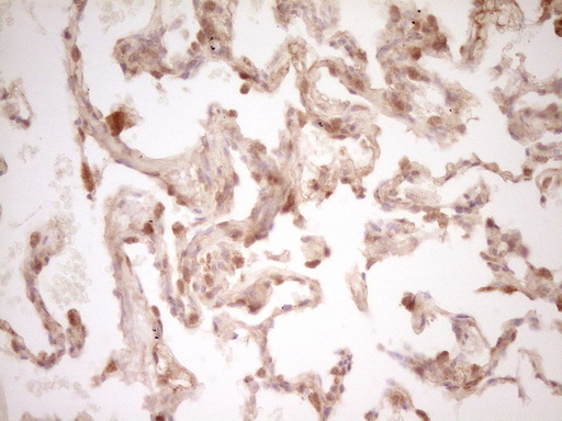 CD40 Antibody - IHC of paraffin-embedded Human lung tissue using anti-CD40 mouse monoclonal antibody. (Heat-induced epitope retrieval by 1 mM EDTA in 10mM Tris, pH8.5, 120°C for 3min).