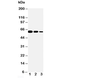 CD40 Antibody - Western blot testing of CD40 antibody and Lane 1: Recombinant mouse protein 10ng; 2: 5ng; 3: 2.5ng