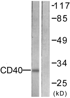 CD40 Antibody - Western blot analysis of lysates from COS7 cells, using CD40 Antibody. The lane on the right is blocked with the synthesized peptide.