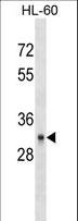 CD40 Antibody - CD40 Antibody (Ascites)western blot of HL-60 cell line lysates (35 ug/lane). The CD40 antibody detected the CD40 protein (arrow).