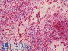 CD40 Antibody - Human Spleen: Formalin-Fixed, Paraffin-Embedded (FFPE)