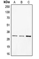CD40 Antibody - Western blot analysis of CD40 expression in BJAB (A); A431 (B); Ramos (C) whole cell lysates.