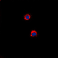 CD40 Antibody - Immunofluorescent analysis of CD40 staining in A431 cells. Formalin-fixed cells were permeabilized with 0.1% Triton X-100 in TBS for 5-10 minutes and blocked with 3% BSA-PBS for 30 minutes at room temperature. Cells were probed with the primary antibody in 3% BSA-PBS and incubated overnight at 4 C in a humidified chamber. Cells were washed with PBST and incubated with a DyLight 594-conjugated secondary antibody (red) in PBS at room temperature in the dark. DAPI was used to stain the cell nuclei (blue).