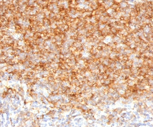 CD40 Antibody - IHC testing of human tonsil with CD40 antibody (clone CDLA40-1). Required HIER: boil tissue sections in 10mM citrate buffer, pH 6, for 10-20 min.