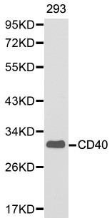 CD40 Antibody - Western blot of CD40 pAb in extracts from 293 cells.