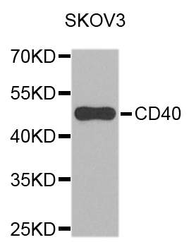 CD40 Antibody - Western blot analysis of extracts of SKOV3 cells.