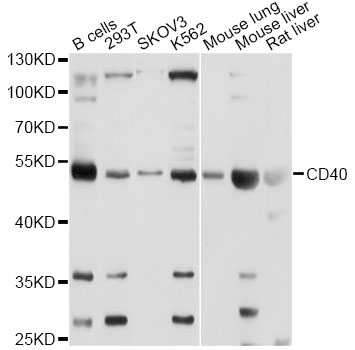 CD40 Antibody - Western blot analysis of extracts of various cell lines, using CD40 antibody at 1:1000 dilution. The secondary antibody used was an HRP Goat Anti-Rabbit IgG (H+L) at 1:10000 dilution. Lysates were loaded 25ug per lane and 3% nonfat dry milk in TBST was used for blocking. An ECL Kit was used for detection and the exposure time was 5s.