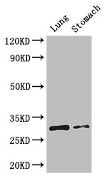 CD40 Antibody - Positive WB detected in:Mouse lung tissue,Mouse stomach tissue;All lanes: TNFRSF5 antibody at 3.2ug/ml;Secondary;Goat polyclonal to rabbit IgG at 1/50000 dilution;Predicted band size: 31,23 kDa;Observed band size: 30 kDa;