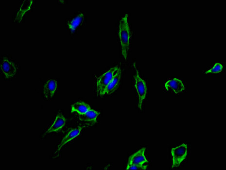 CD40 Antibody - Immunofluorescent analysis of Hela cells using CD40 Antibody at a dilution of 1:100 and Alexa Fluor 488-congugated AffiniPure Goat Anti-Rabbit IgG(H+L)