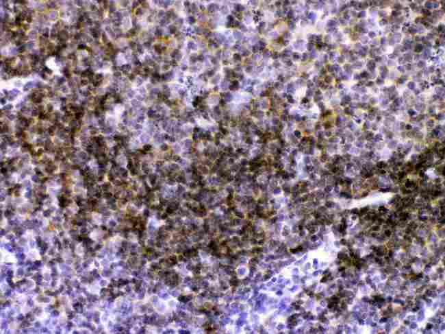 CD40 Antibody - CD40/TNFRSF5 was detected in paraffin-embedded sections of mouse lymphaden tissues using rabbit anti- CD40/TNFRSF5 Antigen Affinity purified polyclonal antibody