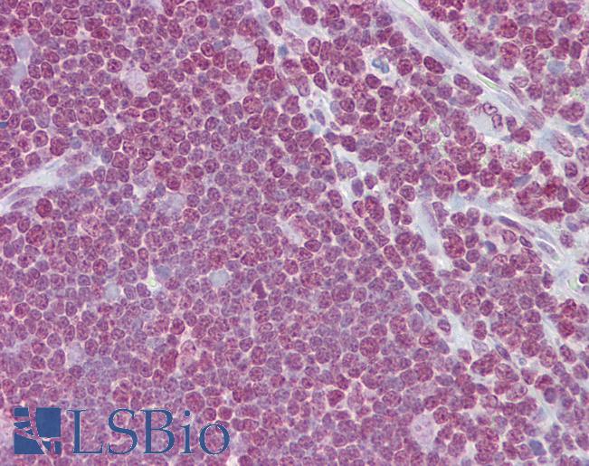 CD40L Antibody - Anti-CD40LG / CD54 antibody IHC of human thymus. Immunohistochemistry of formalin-fixed, paraffin-embedded tissue after heat-induced antigen retrieval. Antibody concentration 5 ug/ml.  This image was taken for the unconjugated form of this product. Other forms have not been tested.