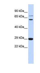 CD40L Antibody - CD40LG / CD54 antibody Western blot of Fetal Muscle lysate. This image was taken for the unconjugated form of this product. Other forms have not been tested.