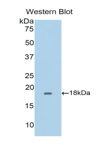 CD40L Antibody - Western blot of recombinant CD40LG / CD40L / CD154.