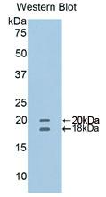 CD40L Antibody - Western Blot; Sample: Recombinant protein.