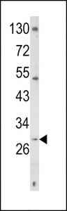 CD40L Antibody - Western blot of TRAP Antibody in K562 cell line lysates (35 ug/lane). TRAP (arrow) was detected using the purified antibody.