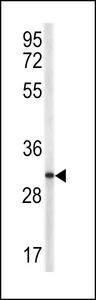 CD40L Antibody - Western blot of TRAP antibody in NCI-H460 cell line lysates (35 ug/lane). TRAP (arrow) was detected using the purified antibody.