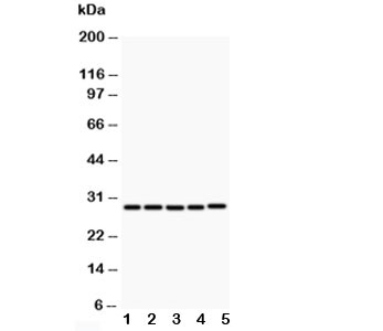 CD40L Antibody - Western blot testing of CD40L antibody and Lane 1: MCF-7; 2: HeLa; 3: Jurkat; 4: HMY2; 5: COLO320; Predicted size: 29KD; Observed size: 29KD
