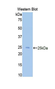 CD40L Antibody - Western blot of recombinant CD40LG / CD40L / CD154.  This image was taken for the unconjugated form of this product. Other forms have not been tested.