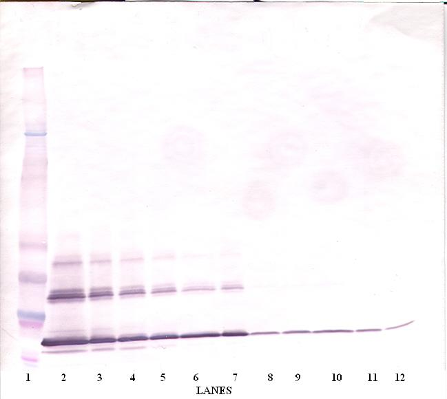 CD40L Antibody - Biotinylated Anti-Human sCD40 Ligand Western Blot Unreduced