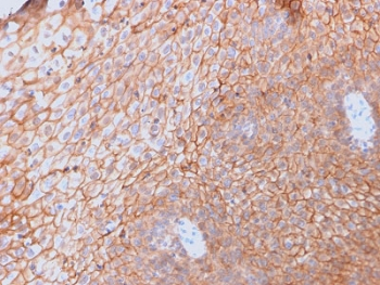 CD40L Antibody - IHC testing of FFPE human spleen with CD40 Ligand antibody (clone CD40LG/2761). HIER: boil tissue sections in pH6, 10mM citrate buffer, for 10-20 min followed by cooling at RT for 20 min.
