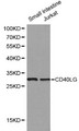 CD40L Antibody - Western blot of CD40 Ligand pAb in extracts from mouse small intestine tissue and Jurkat cells.