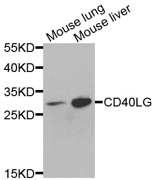 CD40L Antibody - Western blot analysis of extracts of various cell lines, using CD40LG antibody at 1:1000 dilution. The secondary antibody used was an HRP Goat Anti-Rabbit IgG (H+L) at 1:10000 dilution. Lysates were loaded 25ug per lane and 3% nonfat dry milk in TBST was used for blocking.