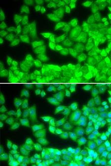 CD40L Antibody - Immunofluorescence analysis of U2OS cells using CD40LG antibody. Blue: DAPI for nuclear staining.