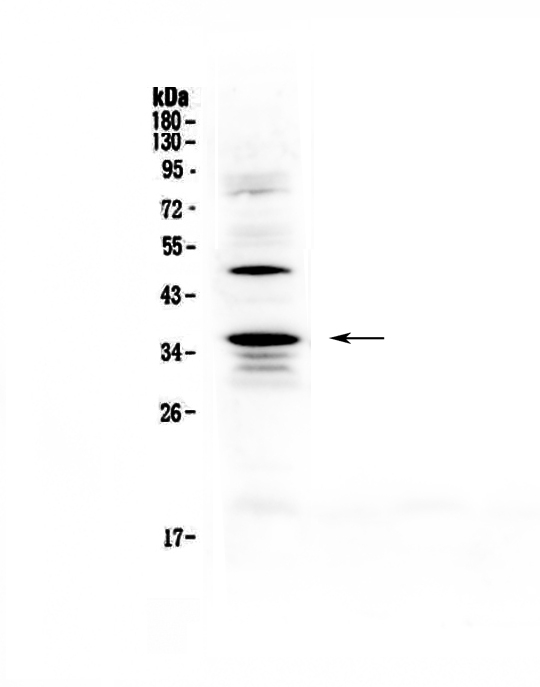 CD40L Antibody - Western blot - Anti-CD40L Picoband antibody