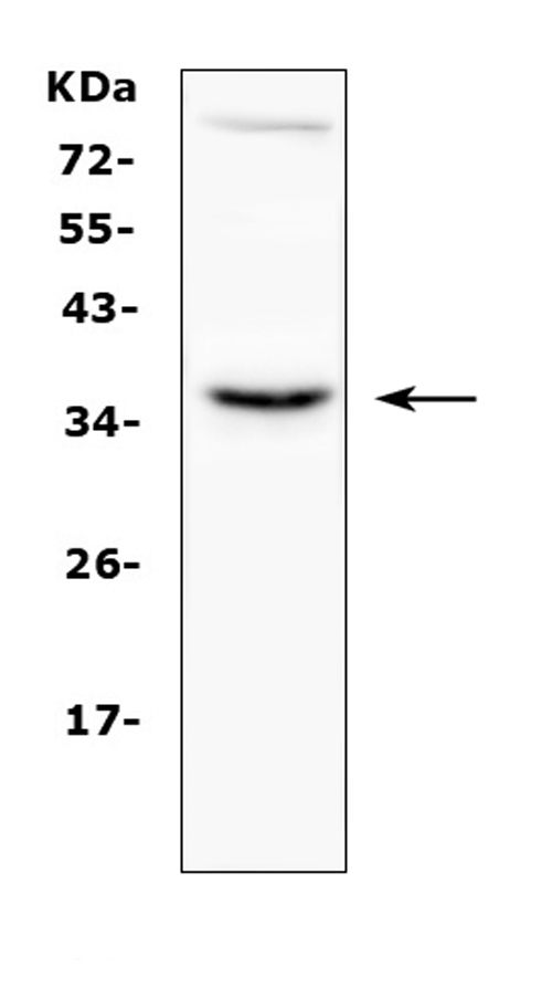 CD40L Antibody - Western blot analysis of CD40L using anti-CD40L antibody. Electrophoresis was performed on a 5-20% SDS-PAGE gel at 70V (Stacking gel) / 90V (Resolving gel) for 2-3 hours. The sample well of each lane was loaded with 50ug of sample under reducing conditions. Lane 1: human MCF-7 whole cell lysates. After Electrophoresis, proteins were transferred to a Nitrocellulose membrane at 150mA for 50-90 minutes. Blocked the membrane with 5% Non-fat Milk/ TBS for 1.5 hour at RT. The membrane was incubated with rabbit anti-CD40L antigen affinity purified polyclonal antibody at 0.5 µg/mL overnight at 4°C, then washed with TBS-0.1% Tween 3 times with 5 minutes each and probed with a goat anti-rabbit IgG-HRP secondary antibody at a dilution of 1:10000 for 1.5 hour at RT. The signal is developed using an Enhanced Chemiluminescent detection (ECL) kit with Tanon 5200 system. A specific band was detected for CD40L at approximately 36KD. The expected band size for CD40L is at 29KD.