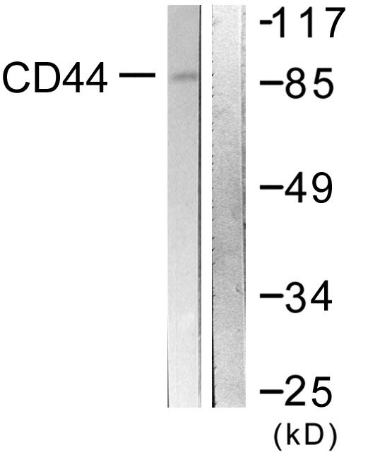 CD44 Antibody - Western blot analysis of lysates from NIH/3T3 cells treated with PMA 250ng/ml 5', using CD44 Antibody. The lane on the right is blocked with the synthesized peptide.