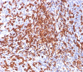 CD44 Antibody - HCAM antibody 156-3C11 immunohistochemistry tonsil.  This image was taken for the unmodified form of this product. Other forms have not been tested.