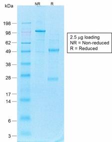 CD44 Antibody - SDS-PAGE Analysis of Purified CD44v4 Rabbit Recombinant Monoclonal Antibody (CD44v4/1700R). Confirmation of Purity and Integrity of Antibody.