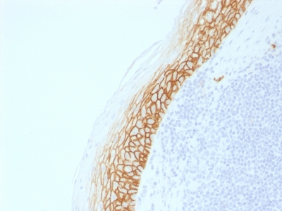 CD44 Antibody - Formalin-fixed, paraffin-embedded human Tonsil stained with CD44v9 Rabbit Recombinant Monoclonal Antibody (CD44v9/2344R).