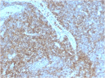 CD44 Antibody - Formalin-fixed, paraffin-embedded human Lymph Node stained with CD44 Rabbit Recombinant Monoclonal Antibody (HCAM/2875R).