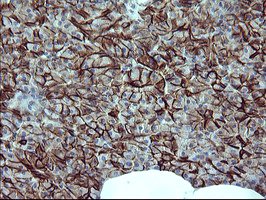 CD44 Antibody - IHC of paraffin-embedded Human pancreas tissue using anti-CD44 mouse monoclonal antibody. (heat-induced epitope retrieval by 1 mM EDTA in 10mM Tris, pH8.5, 120°C for 3min).