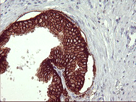 CD44 Antibody - IHC of paraffin-embedded Human prostate tissue using anti-CD44 mouse monoclonal antibody. (heat-induced epitope retrieval by 1 mM EDTA in 10mM Tris, pH8.5, 120°C for 3min).