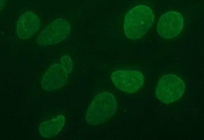 CD44 Antibody - Immunofluorescent staining of HeLa cells using anti-CD44 mouse monoclonal antibody.